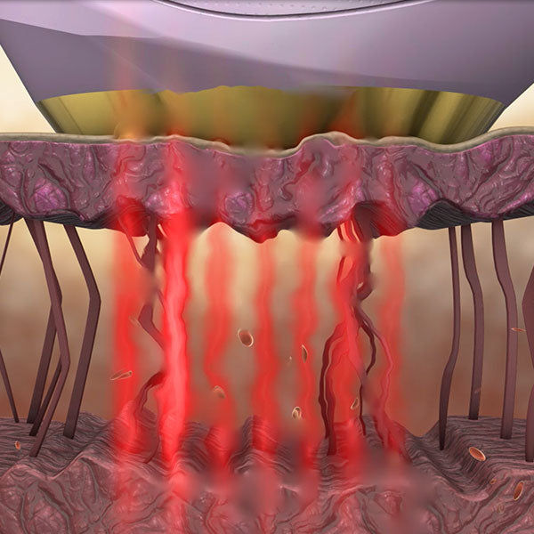The One - Anti-Aging Medical Device